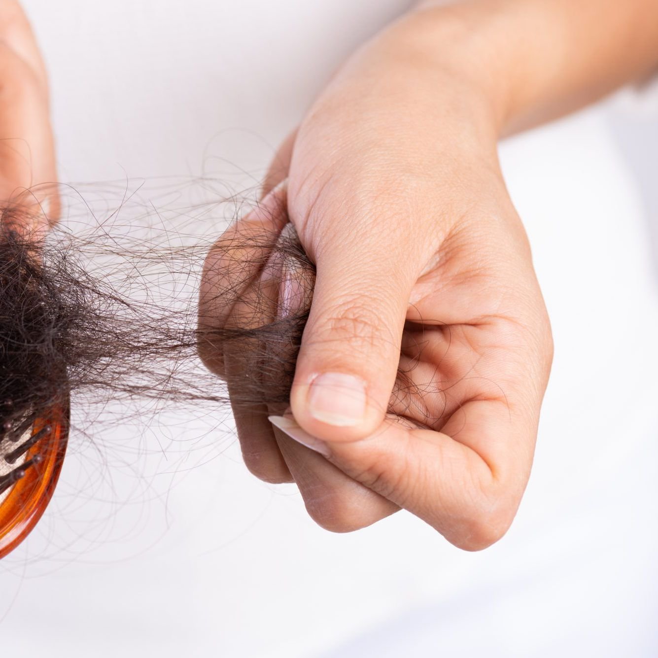 Hair Loss